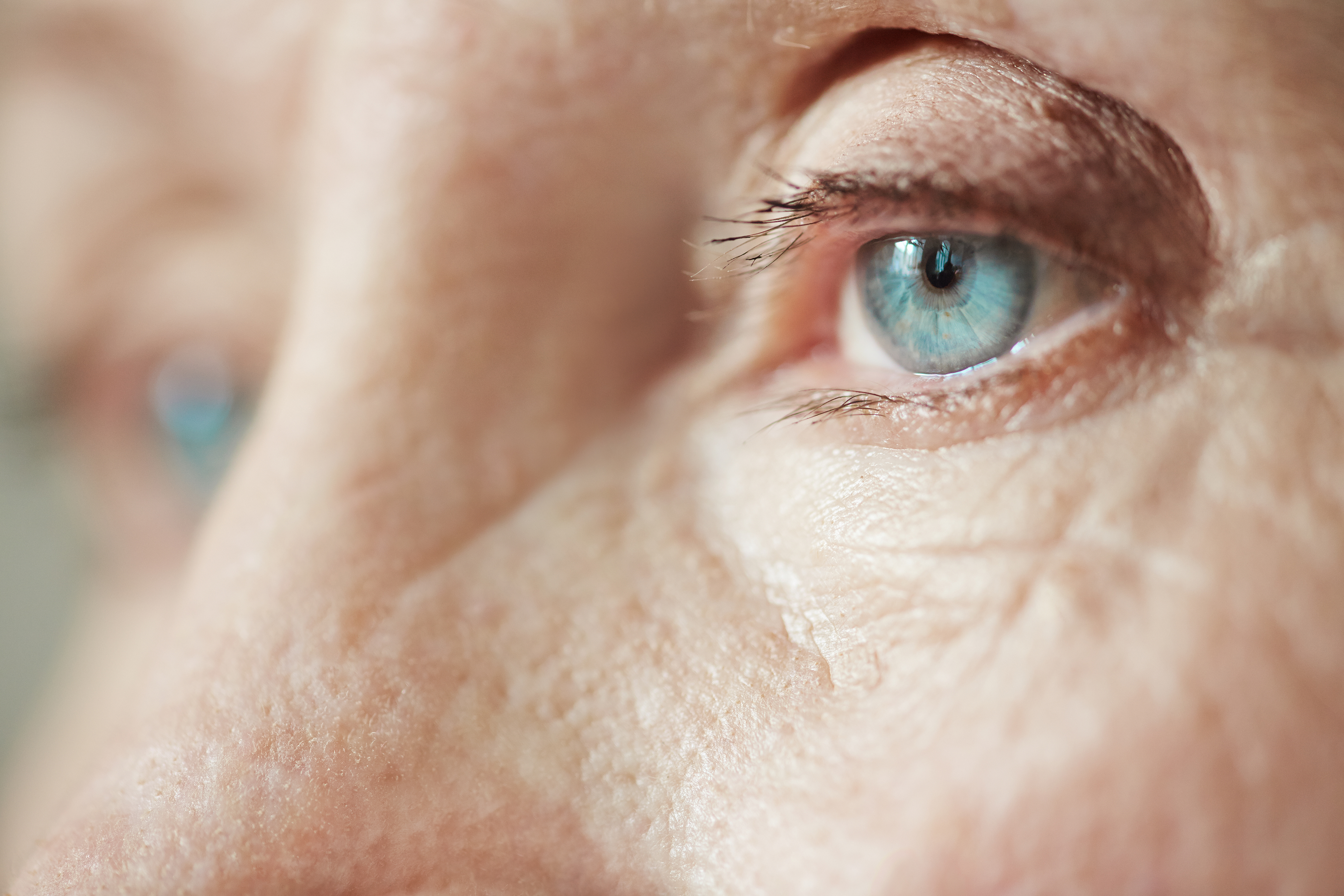 blefaroplastia é capaz de rejuvenescer o seu rosto